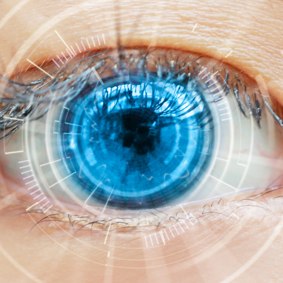 What are cataracts? - Travocure